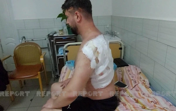 Vinnitsada azərbaycanlıların da mülkləri dağıldı, son statistika açıqlandı - FOTO