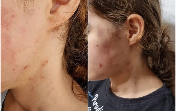 Azərbaycanda vəzifəli şəxslərin məktəblini döyməsi faktı təsdiqini tapdı