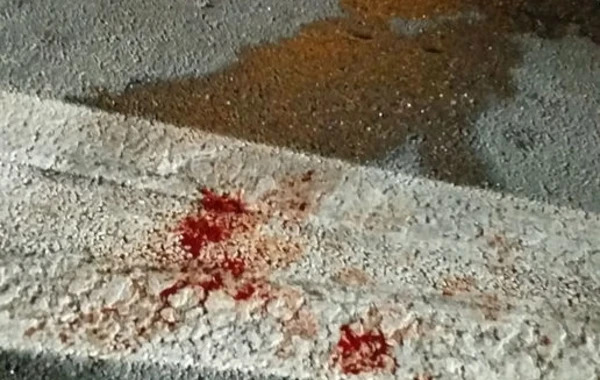 Bakıda avtomobil qəzası: Bir nəfər ölüb, iki nəfər yaralanıb – FOTO/VİDEO