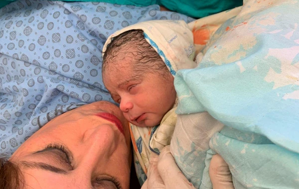 Bakıda 57 yaşlı qadın 15 il sonsuzluqdan sonra ana olub - FOTO