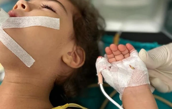 Bakıda 2 yaşlı uşaq bir il nəfəs borusunda sümük parçası ilə yaşayıb - FOTO