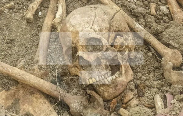 В Ходжавенде обнаружено еще одно массовое захоронение - ФОТО