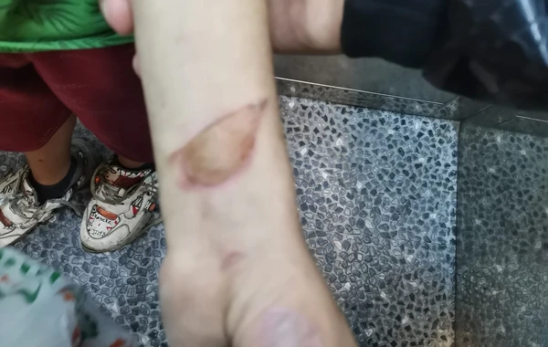В Хырдалане родители нанесли ребенку увечья и оставили его на улице - ФОТО