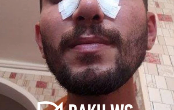Bakıda "parkovşik"lərin yer üstündə davası: Biri digərini qapazladı - ANBAAN VİDEO