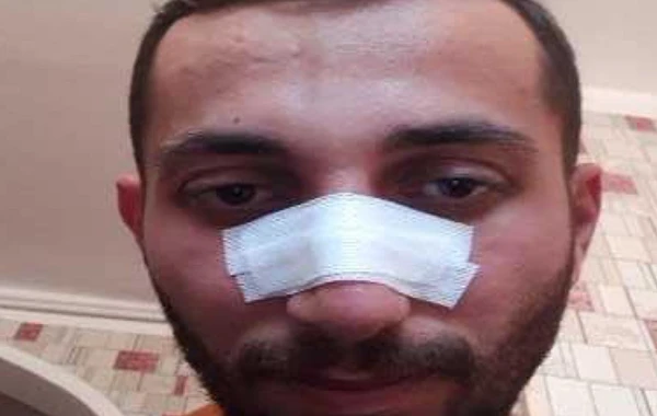 Bakıda "parkovşik"lərin yer üstündə davası: Biri digərini qapazladı - ANBAAN VİDEO
