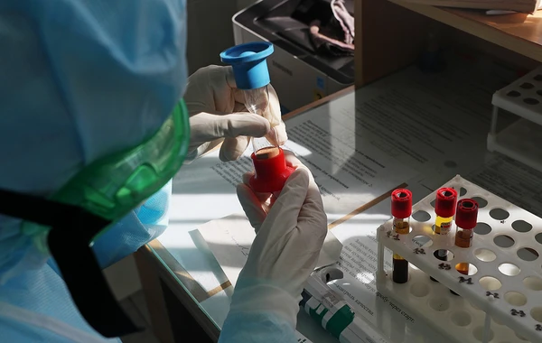 Azərbaycanda son sutkada 45 nəfər koronavirusa yoluxub