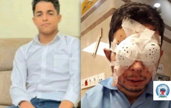 Molla rejiminin kor etdiyi güneyli oğlan İNTİHAR EDİB - FOTO