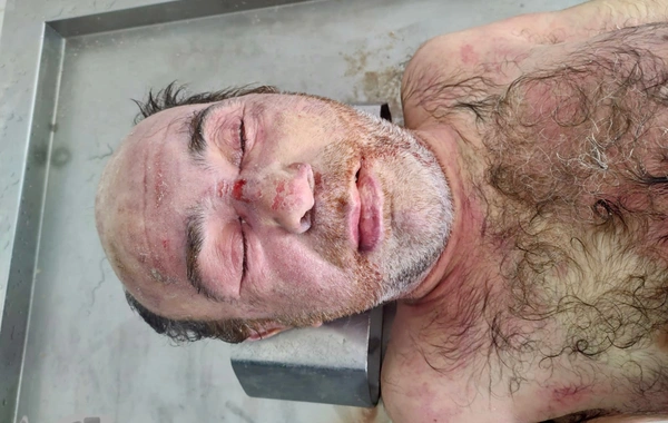 Polis bu şəxsin kimliyini müəyyən etməyə çalışır  - Tanıyanlardan xahiş olunur... - FOTO