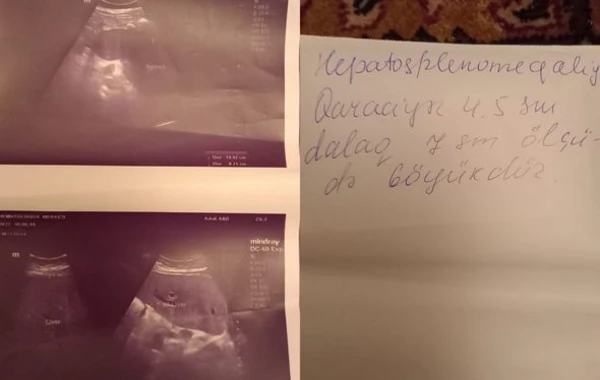 Qaz partlayışından xəsarət alan qadının qızı: “Anamın yenidən ayağa qalxması üçün bizə kömək edin” - FOTO