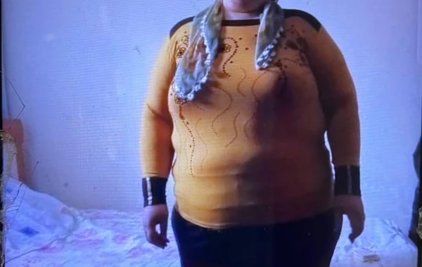 Arıqlamaq üçün internetdən dərman sifariş etdi: Çəkisi 350 kq oldu - FOTO/VİDEO