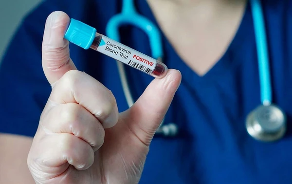 Azərbaycanda koronavirusa yoluxanların sayı AÇIQLANDI