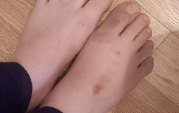 Küçədə qaçırılan qadınla bağlı ŞOK DETALLAR - Gələn gündən şiddət görür - FOTO - YENİLƏNİB