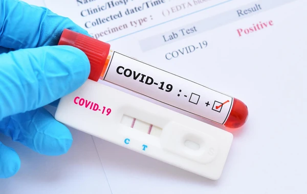 Azərbaycanda daha 17 nəfər COVID-19-a yoluxub, yeddi nəfər vəfat edib