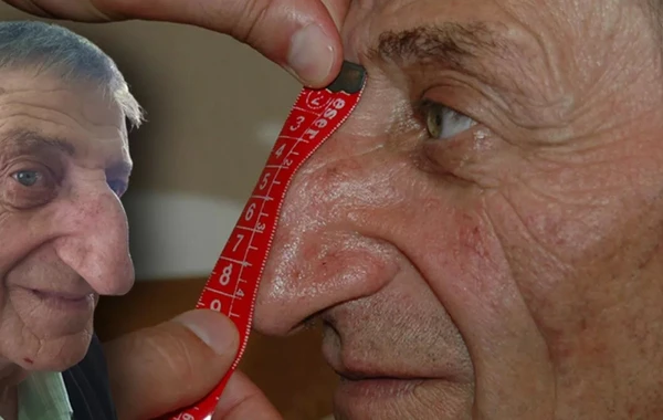 Dünyanın ən uzun burunlu insanı vəfat etdi - FOTO