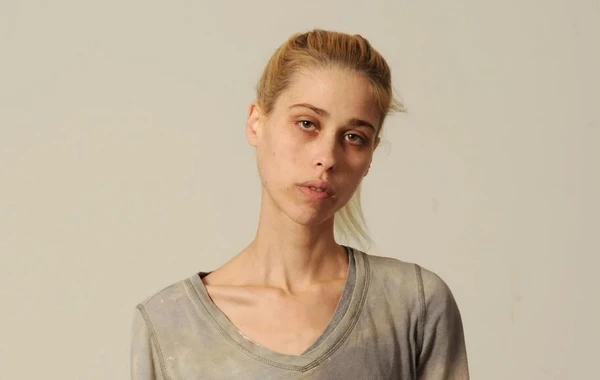 Arıqlamaq istəyən gənc model 24 kq çəkiyə çatıb öldü - FOTO