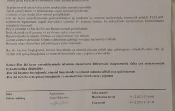 İki ağır xəstəliyi olan Zəhranın anası: “Dərman olmayanda sakitləşməkçün özünə layla oxuyub yatır” -FOTO/VİDEO