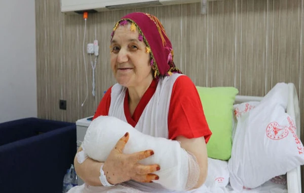 Qəzada 4 barmağı qopan 72 yaşlı qadının barmaqları yerinə tikildi - FOTOLAR