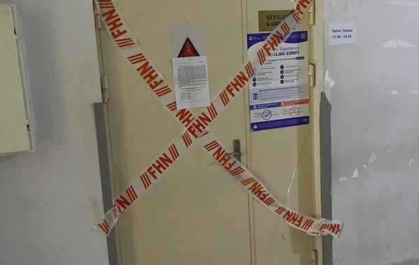 Respublika Klinik Xəstəxanasında rentgen kabinetlərinin fəaliyyəti dayandırılıb - FOTO/VİDEO