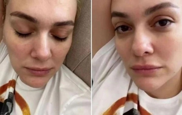 Aktrisa TƏNQİD EDİLDİ: "Hər bölümdən milyonlar qazanıb ağlayır?" - FOTO