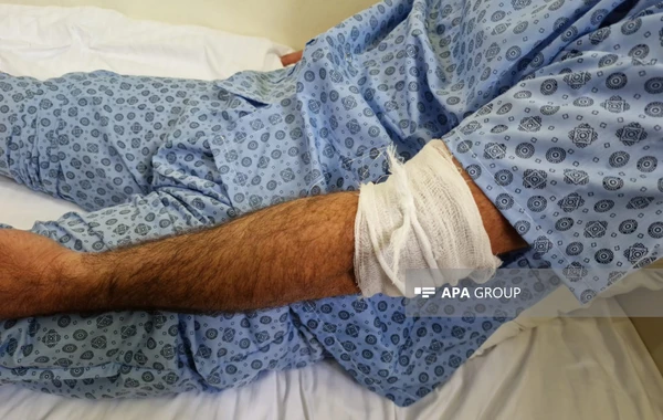 Ermənilərin Ağdamı atəşə tutması nəticəsində xəsarət alan ekskavatorçunun vəziyyəti açıqlanıb - FOTO