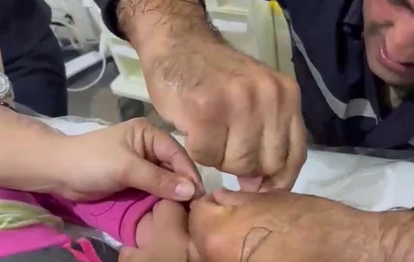 Bərdədə uşağın barmağında dəmir halqanın sıxışması FHN-in müdaxiləsinə səbəb oldu - VİDEO