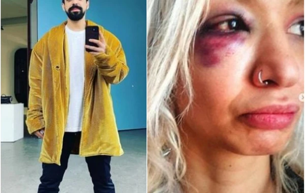 Müğənnini bu hala salan sevgilisi indi də ona GÜLLƏ GÖNDƏRDİ - FOTO