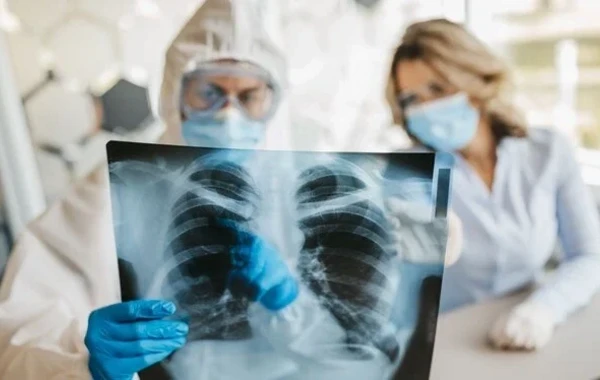 Narahatedici vəziyyət: Bu virus ilk dəfə bir insanda tapıldı