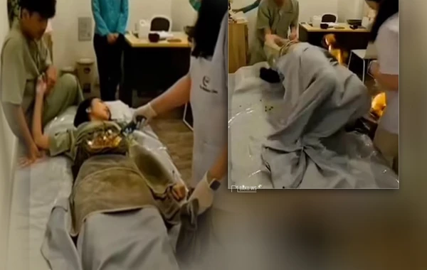 Məşhur model türkəçarə zamanı od tutub yandı - FOTO/VİDEO
