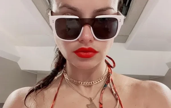Adriana Lima estetik etdirib? - AÇIQLAMA - FOTO
