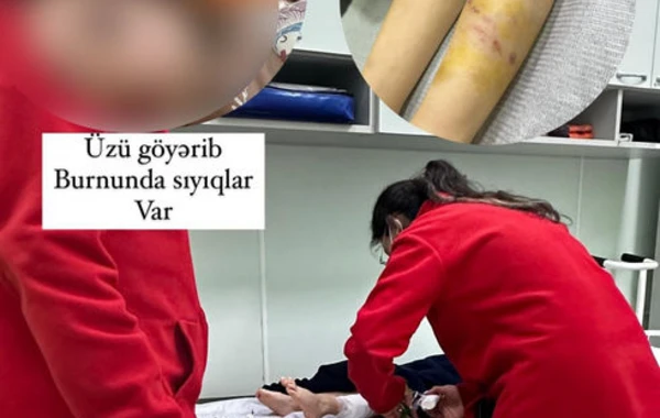 Bakıda it ana və qızına hücum etdi -  ANBAAN VİDEO/FOTO