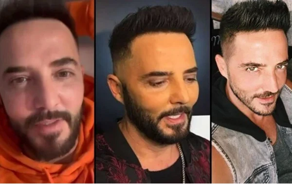 Gökhan Özen yayılan görüntüsündən danışdı: "Kefimi poza bilməzsiniz" - FOTO
