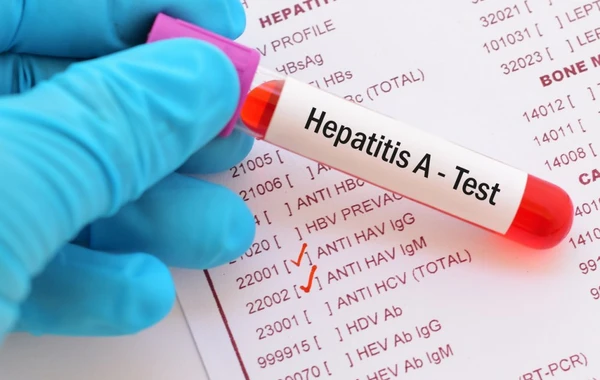 Bu yaş aralığı insanlar Hepatit A virusuna daha çox yoluxur - SN açıqladı