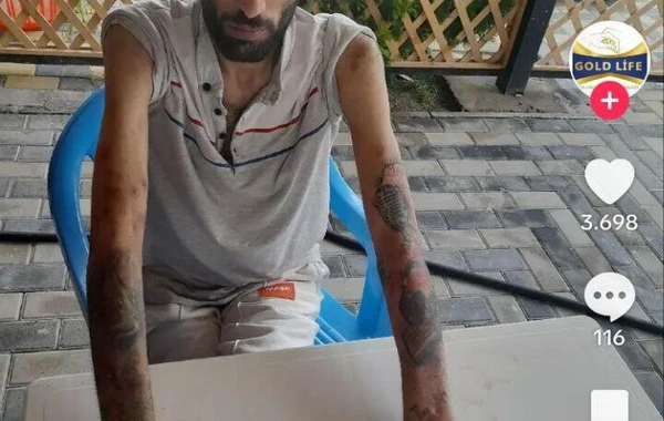 Tanınmış azərbaycanlı reperin bu halı görənləri DƏHŞƏTƏ GƏTİRİR - FOTO