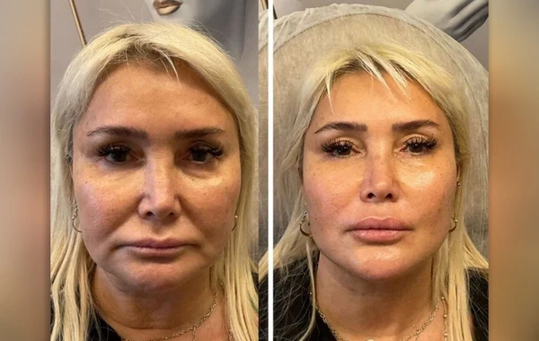 60 yaşlı Evcimik xarici görünüşü ilə bağlı ilk dəfə danışdı - FOTO