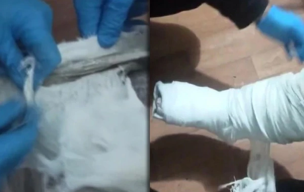 Sərnişinin ayağındakı gipsdən 293 qram heroin çıxdı - FOTO/VİDEO