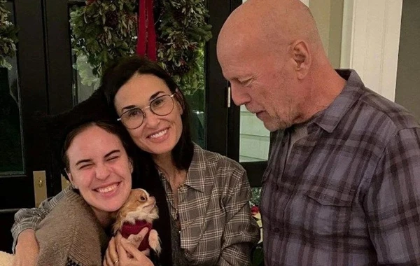 Brüs Uillisin 30 yaşlı qızı bu xəstəlikdən əziyyət çəkir - FOTO
