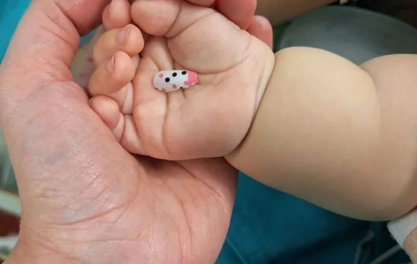 Bacısının plastik dırnağı 6 aylıq körpəni xəstəxanalıq etdi - FOTO