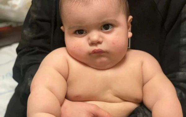 Bacısının plastik dırnağı 6 aylıq körpəni xəstəxanalıq etdi - FOTO
