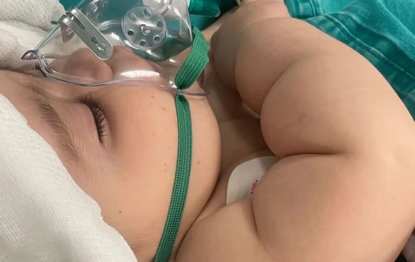 Bacısının plastik dırnağı 6 aylıq körpəni xəstəxanalıq etdi - FOTO