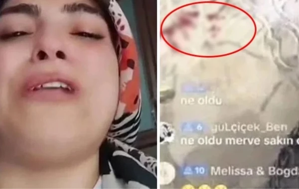Övladı qan içində canlı yayım açan Tik-Tok istifadəçisi saxlanılıb - VİDEO