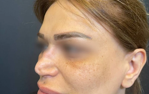Baku Medical Plazada daha bir unikal əməliyyat keçirilib - FOTO/VİDEO