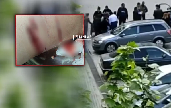 Sahibsiz itlər Xırdalanda sakinə hücum etdilər - FOTO/VİDEO