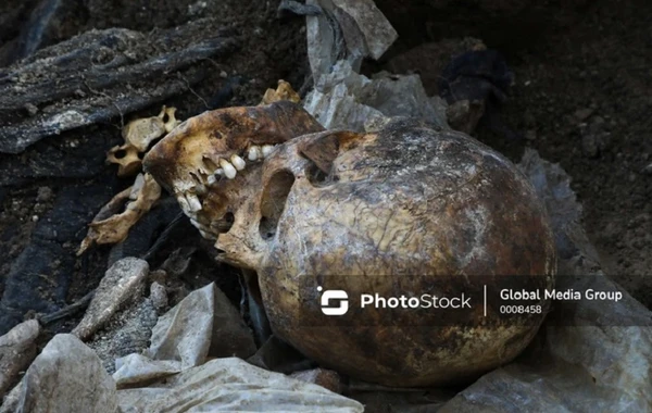 Во дворе Siyəzən Broyler обнаружены человеческие кости