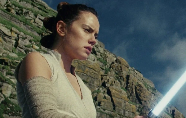 "Star Wars" serialının aktrisasında bu xəstəlik aşkarlandı - FOTO