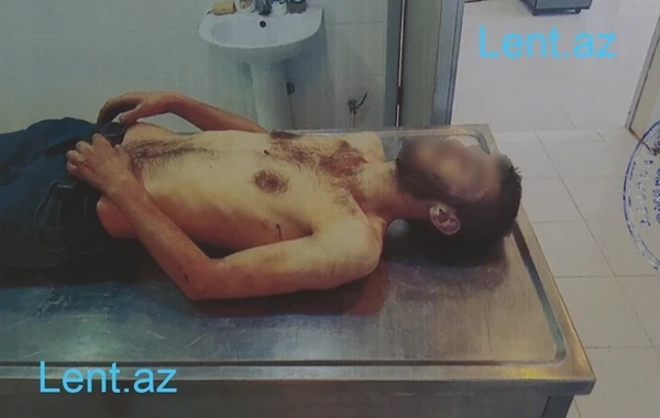 Bakıda qardaş qətli ilə sonlanan ailə faciəsinin TƏFƏRRÜATI - Amansız cinayətdən GÖRÜNTÜ