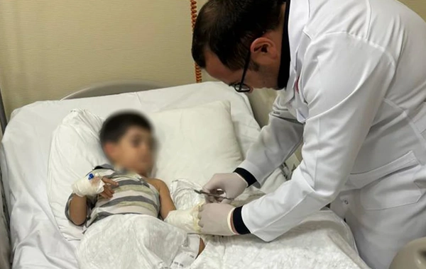 3 yaşlı uşağın ət maşınında ağır yaralanan əli 8 saatlıq mikrocərrahi əməliyyatla bərpa edildi
