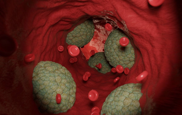 Назван неочевидный фактор риска преждевременной смерти