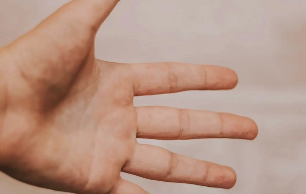 Nevroloq Parkinson xəstəliyinin ilkin əlamətlərini açıqladı