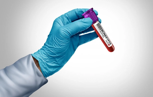 Врачи бьют тревогу: на Европу наступает мутировавший штамм обезьяньей оспы