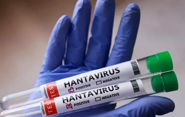 Venesuelada hantavirus diaqnozu təsdiqlənmiş üç pasiyent ölüb